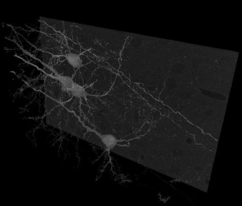 CIL:40260, Mus musculus, pyramidal cell