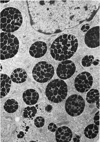 CIL:36000, Rhipicephalus appendiculatus, secretory cell