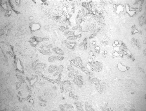 CIL:32273, Homo sapiens, endocrine-paracrine cell of prostate gland, basal cell of prostate epithelium, luminal cell of prostate epithelium, blood vessel endothelial cell, perineural cell, sheath cell, leukocyte, prostate stromal cell, smooth muscle cell of prostate