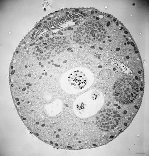 CIL:36249, Vorticella convallaria, cell by organism, eukaryotic cell, Eukaryotic Protist, Ciliated Protist
