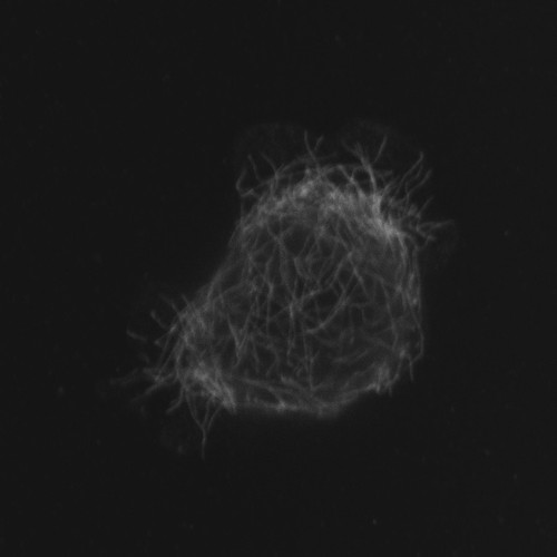 CIL:12294, Homo sapiens, epithelial cell