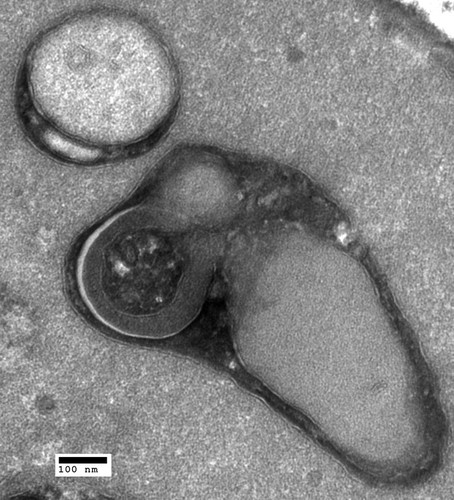 CIL:40423, Saccharomyces cerevisiae, sac1∆∆ mutant