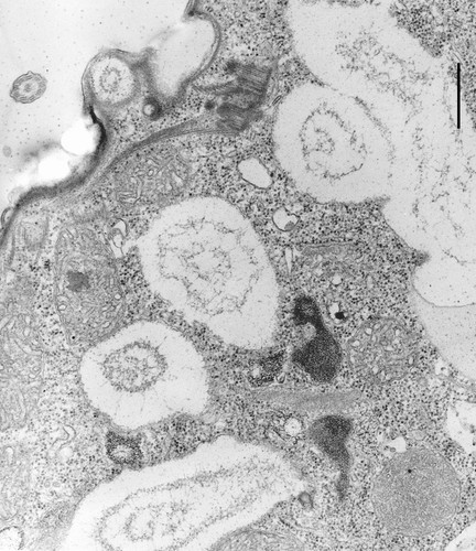 CIL:12107, Colpoda cucullus, cell by organism, eukaryotic cell, Eukaryotic Protist, Ciliated Protist