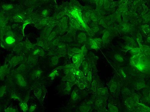 CIL: 54770, Homo sapiens, SBAD2 human iPSC line