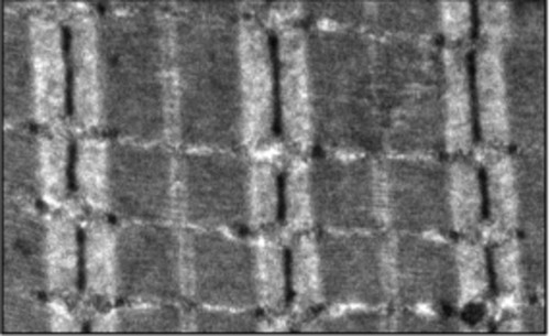 CIL:10078, Mus musculus, skeletal muscle cell