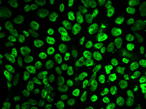 CIL: 54750, Homo sapiens, SBAD2 human iPSC line