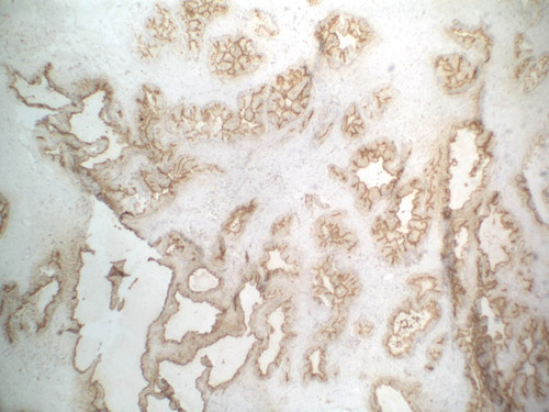 CIL:32593, Homo sapiens, endocrine-paracrine cell of prostate gland, basal cell of prostate epithelium, luminal cell of prostate epithelium, blood vessel endothelial cell, perineural cell, sheath cell, leukocyte, prostate stromal cell, smooth muscle cell of prostate