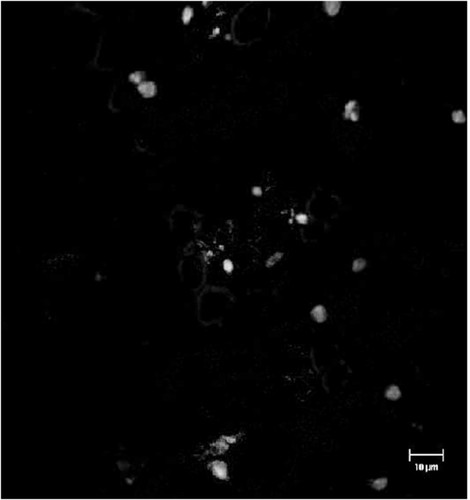 CIL:12592, Spiroplasma kunkelii, Zea mays, plant cell, prokaryotic cell