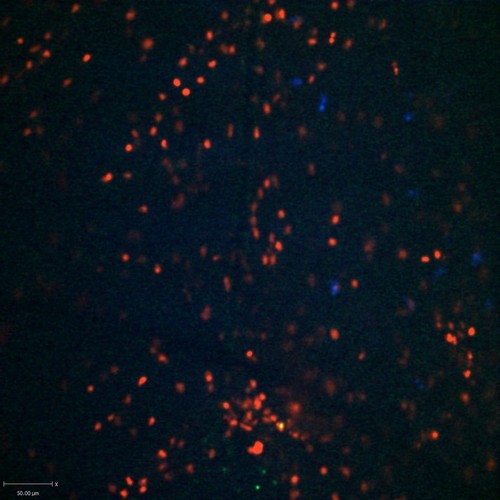 CIL:47322, Staphylococcus aureus, neutrophil, endothelial cell