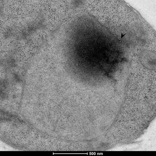 CIL: 50857, Saccharomyces cerevisiae (baker's yeast, budding yeast), Mixed population of S. cerevisiae cells