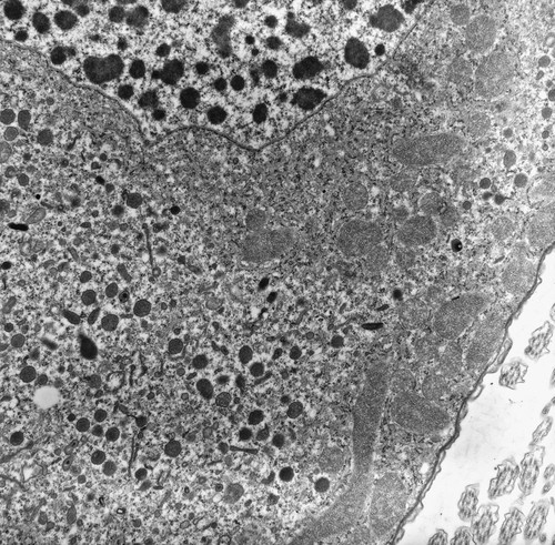 CIL:24922, uncultured Scuticociliatia, Ancistrum sp., cell by organism, eukaryotic cell, Eukaryotic Protist, Ciliated Protist