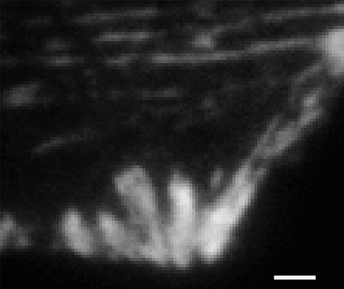 CIL:38599, Homo sapiens, fibroblast