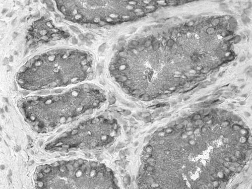 CIL:32384, Homo sapiens, endocrine-paracrine cell of prostate gland, basal cell of prostate epithelium, luminal cell of prostate epithelium, blood vessel endothelial cell, perineural cell, sheath cell, leukocyte, prostate stromal cell, smooth muscle cell of prostate