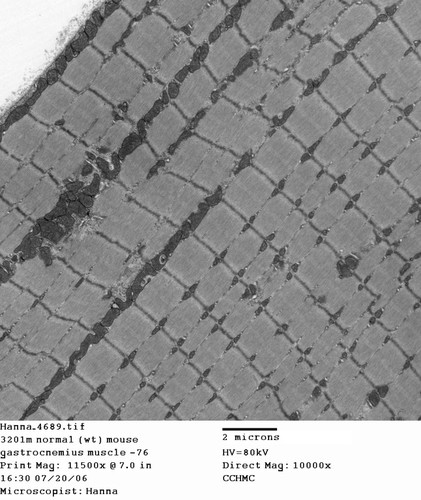 CIL:340, Mus musculus, skeletal muscle cell