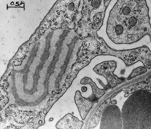 CIL:37177, Rattus, kidney cell, glomerular endothelial cell, podocyte