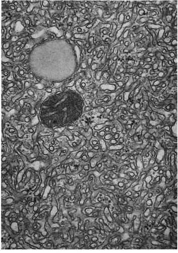 CIL:10804, endocrine cell