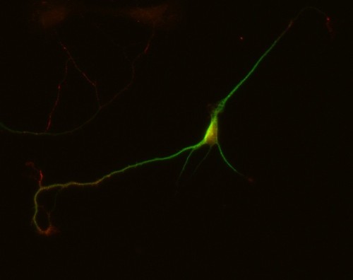 CIL:10253, Rattus, multipolar neuron