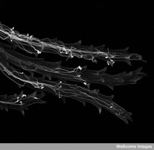 CIL:38806, Claviceps, Triticum aestivum, fungal cell