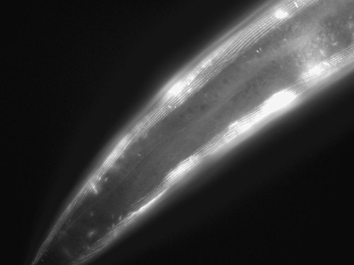 CIL:1039, Caenorhabditis elegans, muscle cell