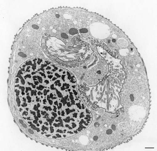 CIL:9824, Opercularia [NCBITaxon:168247], Opercularia coarctata, cell by organism, eukaryotic cell, Eukaryotic Protist, Ciliated Protist