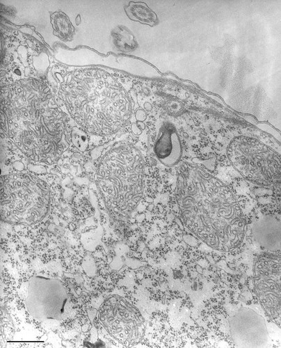 CIL:36225, Tetrahymena pyriformis, cell by organism, eukaryotic cell, Eukaryotic Protist, Ciliated Protist