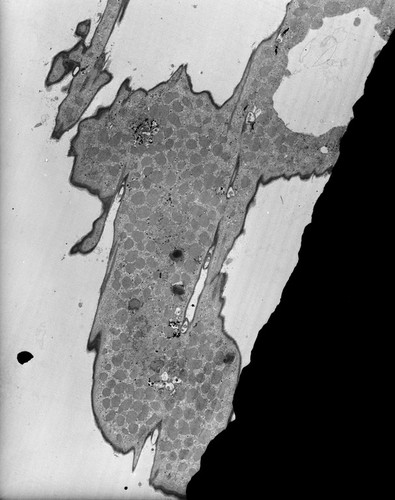 CIL:38869, Euplotes sp., cell by organism, eukaryotic cell, Eukaryotic Protist, Ciliated Protist