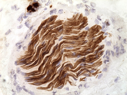 CIL:32665, Homo sapiens, endocrine-paracrine cell of prostate gland, basal cell of prostate epithelium, luminal cell of prostate epithelium, blood vessel endothelial cell, perineural cell, sheath cell, leukocyte, prostate stromal cell, smooth muscle cell of prostate