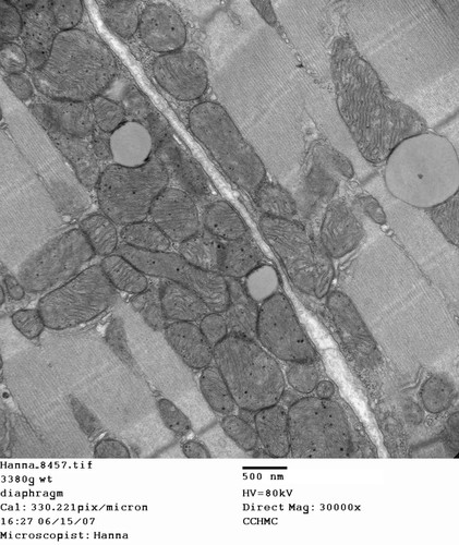 CIL:253, Mus musculus, skeletal muscle cell