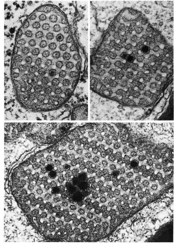 CIL:11435, Xenopus, Sertoli cell