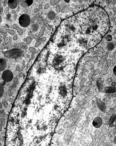 CIL:25364, Maize mosaic virus, Peregrinus maidis, secretory cell