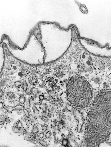 CIL:39309, Paramecium multimicronucleatum, cell by organism, eukaryotic cell, Eukaryotic Protist, Ciliated Protist