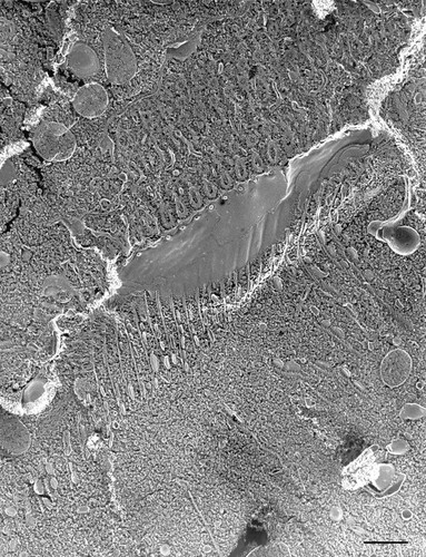 CIL:36700, Paramecium multimicronucleatum, cell by organism, eukaryotic cell, Eukaryotic Protist, Ciliated Protist