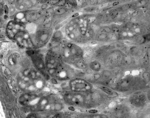 CIL:49001, Mus musculus, parietal cell, zymogen, mucus