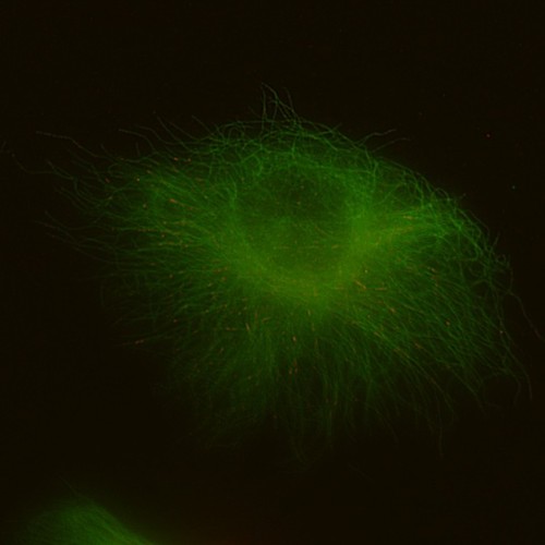 CIL:31262, Homo sapiens, epithelial cell, renal cell carcinoma