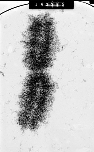 CIL:40683, Mus musculus, fibroblast