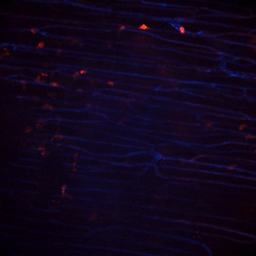 CIL:47577, Staphylococcus aureus, neutrophil, endothelial cell