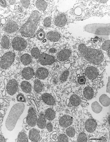 CIL:36630, Paramecium multimicronucleatum, cell by organism, eukaryotic cell, Eukaryotic Protist, Ciliated Protist