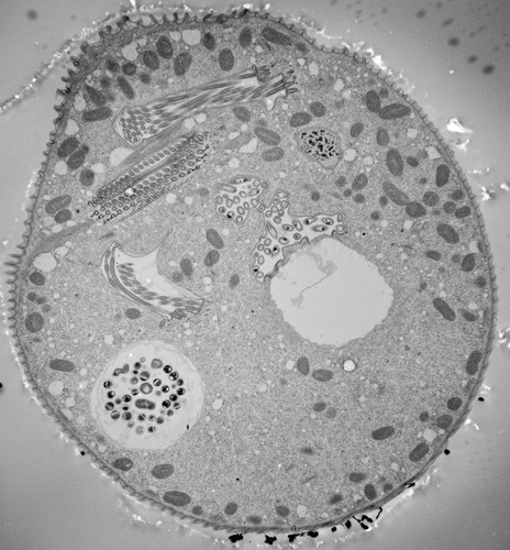 CIL:40570, Vorticella convallaria, cell by organism, eukaryotic cell, Eukaryotic Protist, Ciliated Protist