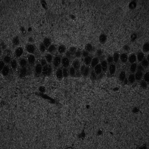 CIL:40148, Mus musculus, CNS neuron (sensu Vertebrata)