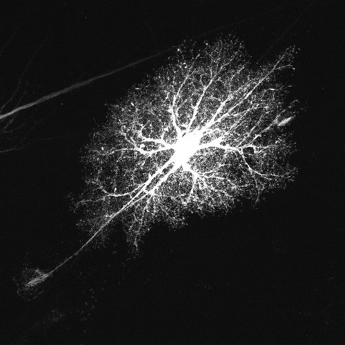 CIL:36357, Rattus norvegicus, astrocyte, astrocyte of the hippocampus