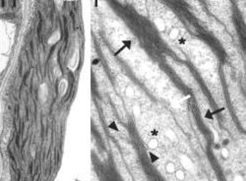 CIL:39126, Arabidopsis thaliana, leaf