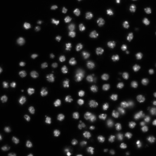 CIL:32137, Drosophila melanogaster, epithelial cell