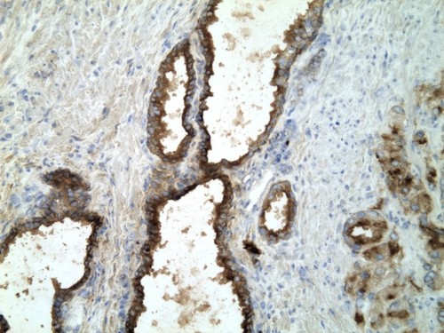 CIL:32187, Homo sapiens, endocrine-paracrine cell of prostate gland, basal cell of prostate epithelium, luminal cell of prostate epithelium, blood vessel endothelial cell, perineural cell, sheath cell, leukocyte, prostate stromal cell, smooth muscle cell of prostate