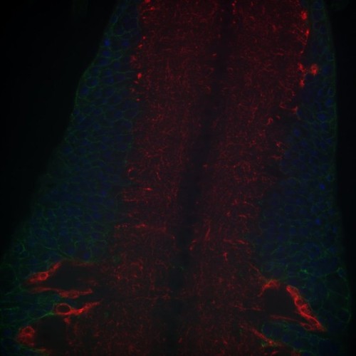 CIL: 54658, Drosophila melanogaster, astrocytes (red)