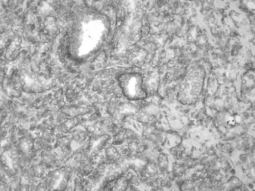 CIL:33965, Homo sapiens, endocrine-paracrine cell of prostate gland, basal cell of prostate epithelium, luminal cell of prostate epithelium, blood vessel endothelial cell, perineural cell, sheath cell, leukocyte, prostate stromal cell, smooth muscle cell of prostate