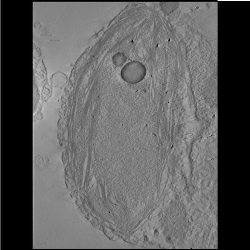 CIL:39984, Phaeocystis antarctica, algae