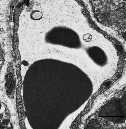 CIL:39779, Mus musculus, capillary endothelial cell, blood cell