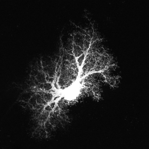 CIL:39942, Rattus norvegicus, astrocyte, astrocyte of the hippocampus