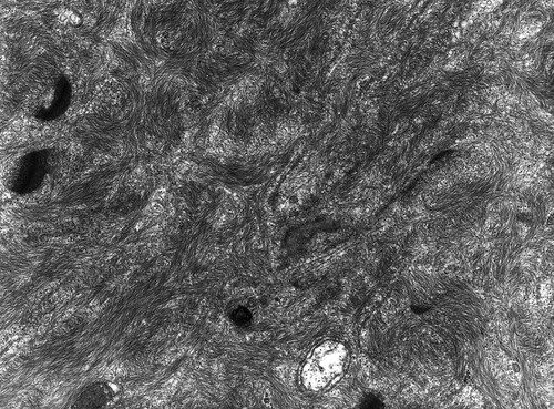 CIL:10441, Rana catesbeiana, barrier epithelial cell