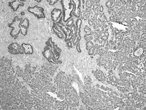 CIL:32360, Homo sapiens, endocrine-paracrine cell of prostate gland, basal cell of prostate epithelium, luminal cell of prostate epithelium, blood vessel endothelial cell, perineural cell, sheath cell, leukocyte, prostate stromal cell, smooth muscle cell of prostate